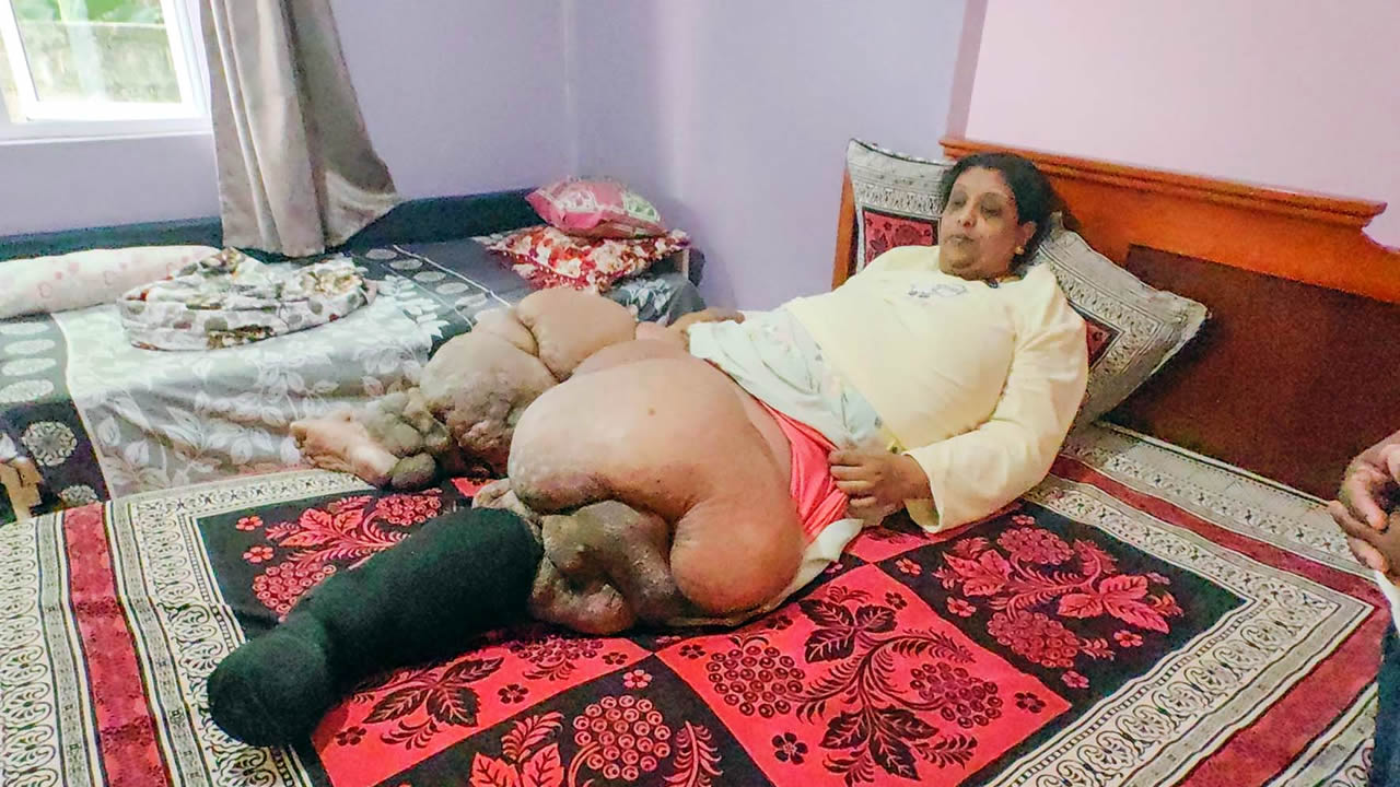 Going to India for treatment: Leena's upsetting daily life facing a rare disease