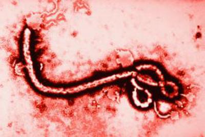 Epidemic: 4-scenario protocol against Ebola initiated