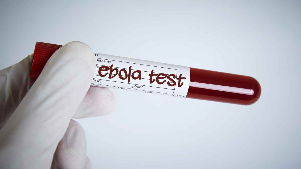Health: twelve people in quarantine as part of preventive measures against Ebola